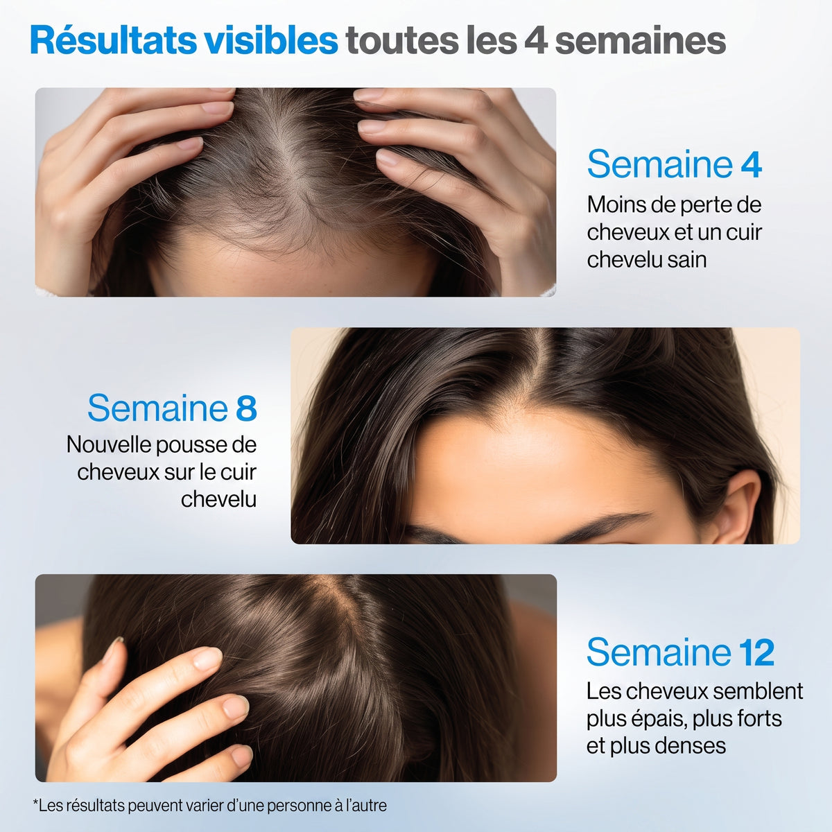 Le Sérum Accélérateur de Pousse